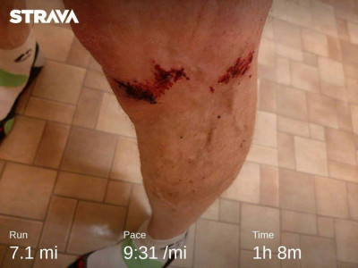 Ouchy1