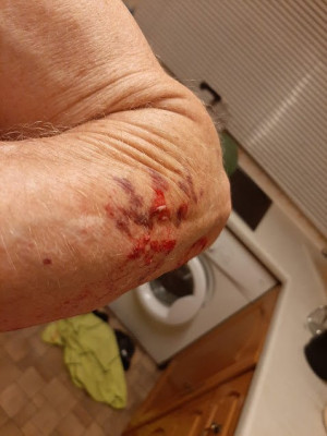 Ouchy2