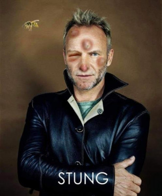 stungs.jpg