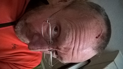 headgash.jpg (339.36 KiB) Viewed 45 times Own Work