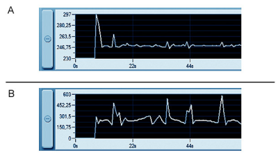 x7 graph.PNG