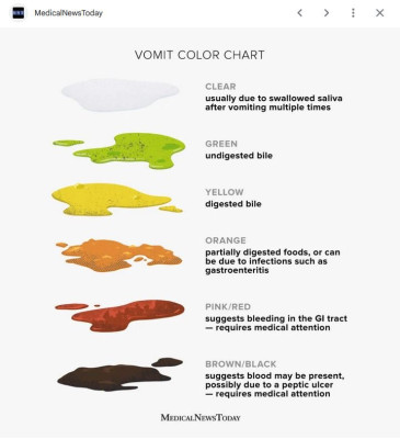 Vomit colour chart - Medical News Today
