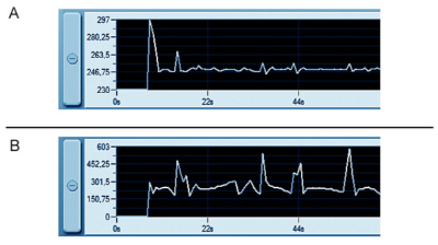 fuel pressure.PNG